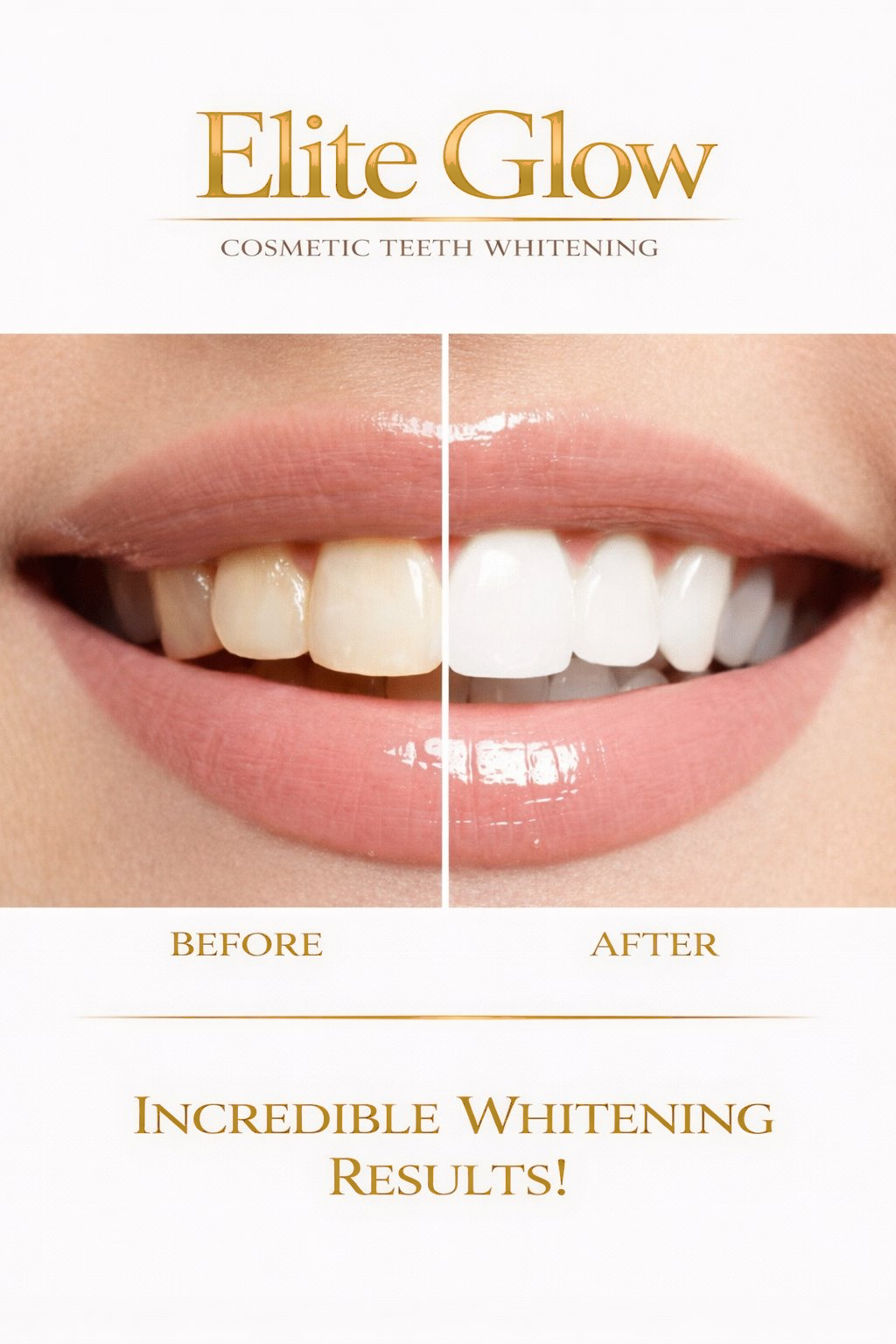 Before and after teeth whitening results